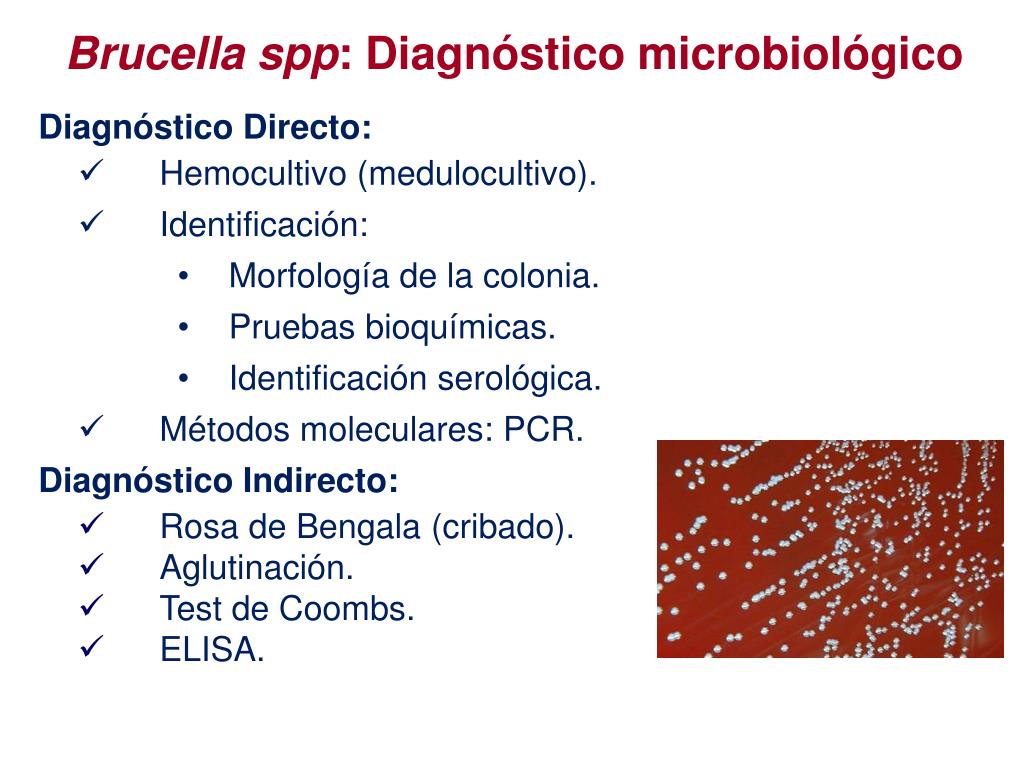 Haemophilus spp у мужчин. Бордетеллы таксономия микробиология. Brucella SPP что это. Бруцелла.