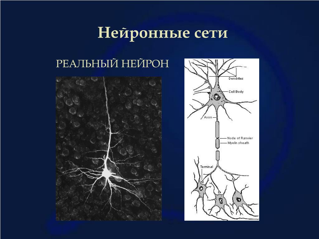 Осуществляет связь между нейронами какой нейрон. Синапсы Нейроны аксоны. Нейроны головного мозга строение. Нервная клетка Нейрон. Разрушение нервных клеток.