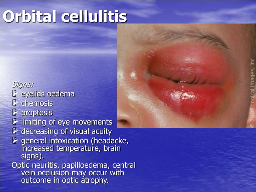 PPT Lecture 6 THE CHANGES OF VISUAL ORGAN IN SYSTEMIC DISEASES PPT Lecture 6 THE CHANGES OF VISUAL ORGAN IN SYSTEMIC DISEASES