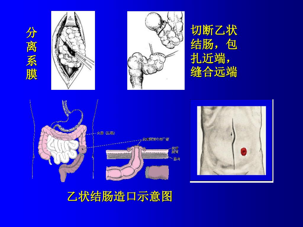 六、腹膜与腹膜后间隙层面(图3-3～图3-4)-特种医学-医学