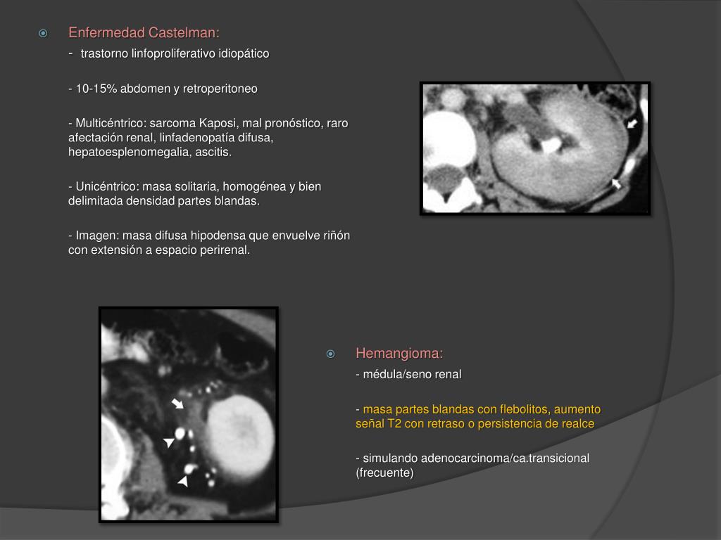 dolor pélvico abdominal icd 10 dolor pélvico abdominal icd 10