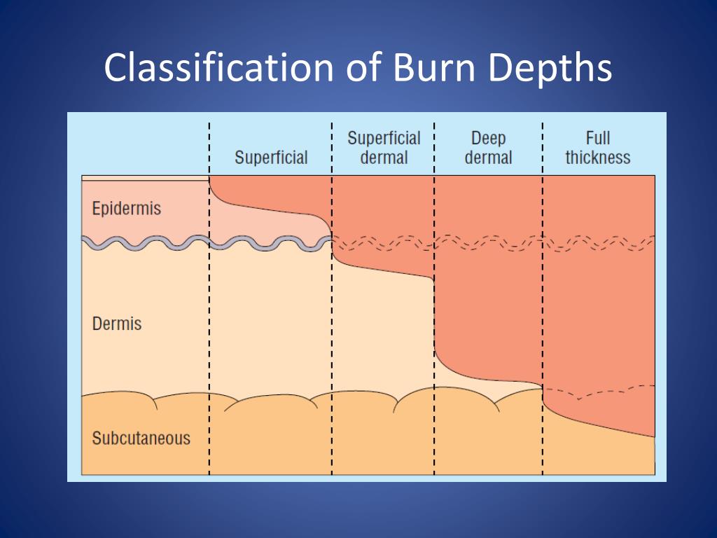 trips referral burns