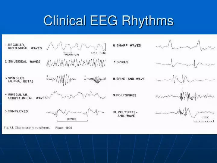 PPT Clinical EEG Rhythms PowerPoint Presentation, free