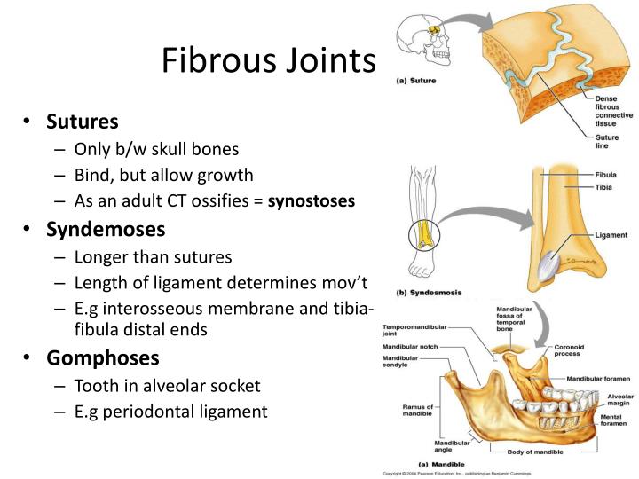 Types Of Fibrous Joints 7758