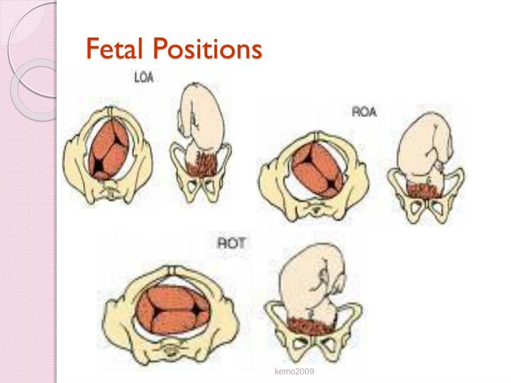Best Fetal Position Optimal Fetal Positioning Exercises For Natural Best Fetal Position Optimal Fetal Positioning Exercises For Natural