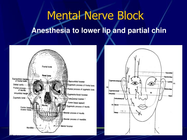 Ppt Nerve Blocks Powerpoint Presentation Id 6088129