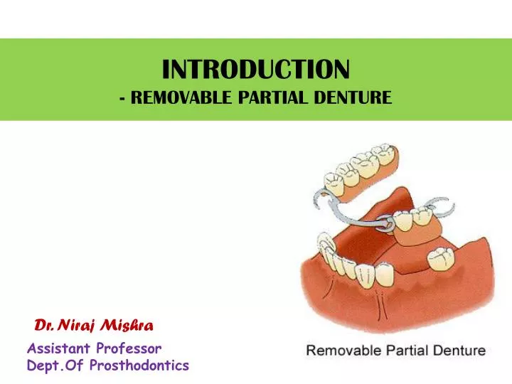 introduction removable partial denture n.