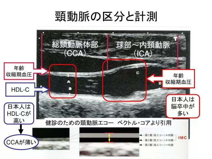 PPT - 頸動脈の区分と計測 PowerPoint Presentation, free download 