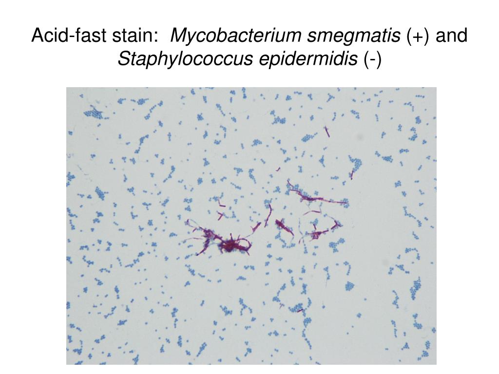 Staphylococcus aureus 10 4