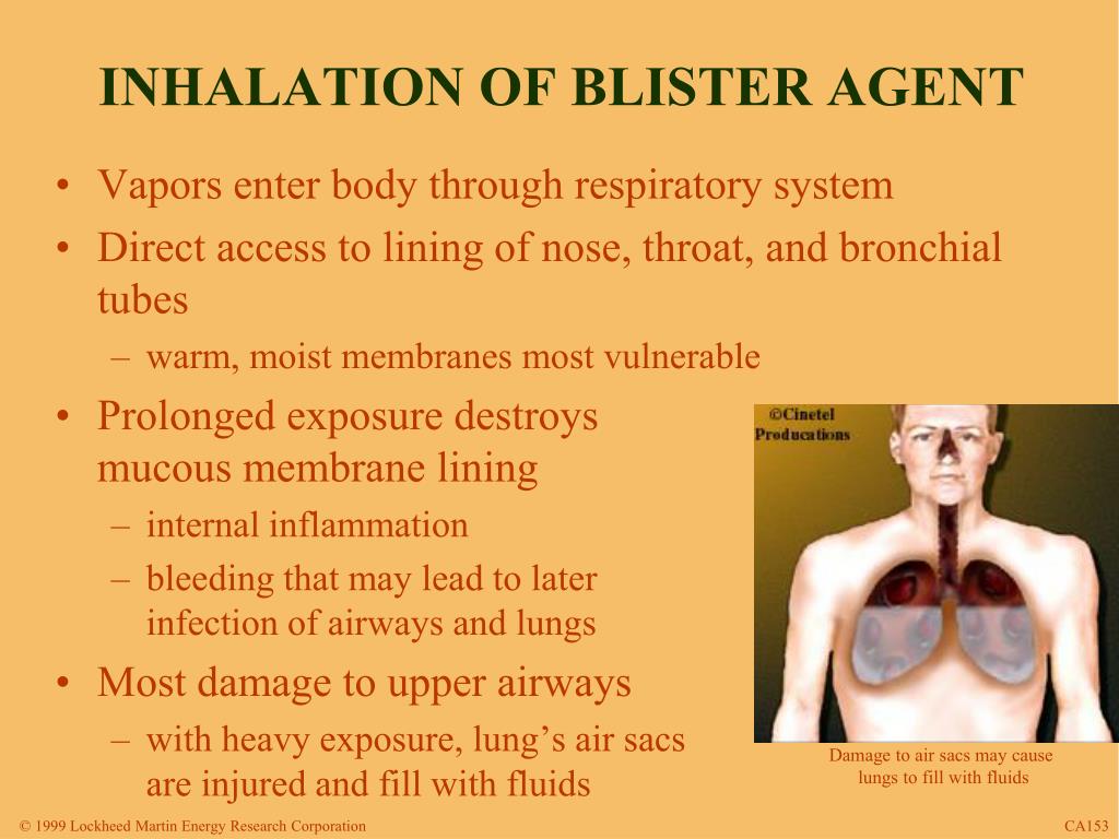 Ppt Blister Agent Exposure Powerpoint Presentation Free Download