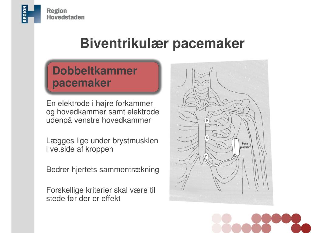 PPT - Hjerte-Kar sygdomme PowerPoint Presentation, free download ...