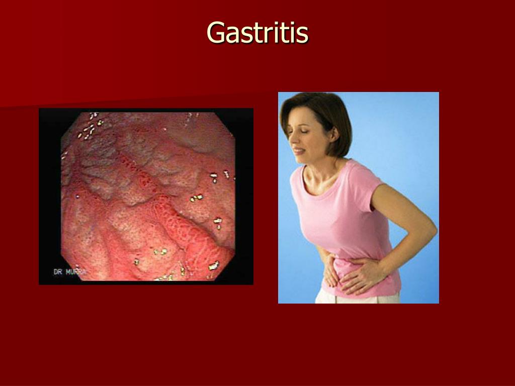 PPT Clinical pharmacology of gastrointestinal agents PowerPoint