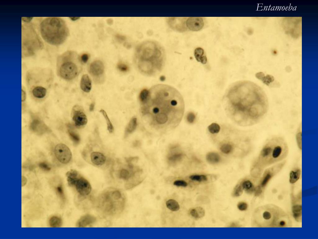Entamoeba coli в кале. Entamoeba histolytica циста. Дизентерийная амеба препарат. Дизентерийная амеба микроскоп. Циста дизентерийной амебы.