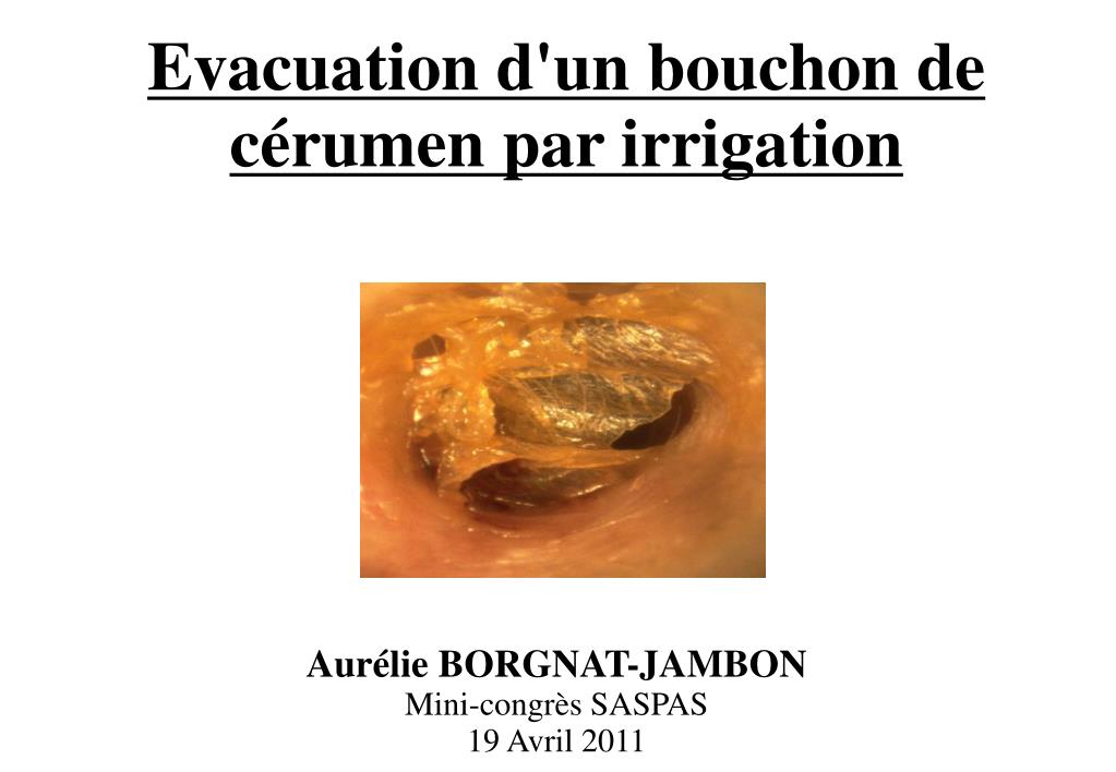 PPT - Evacuation d'un bouchon de cérumen par irrigation PowerPoint  Presentation - ID:6121343