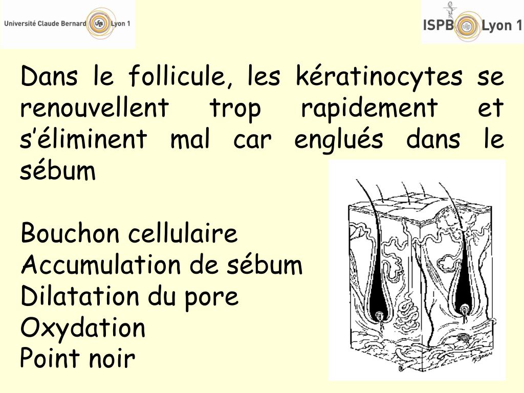 PPT - L 'acné PowerPoint Presentation, free download - ID:6131189