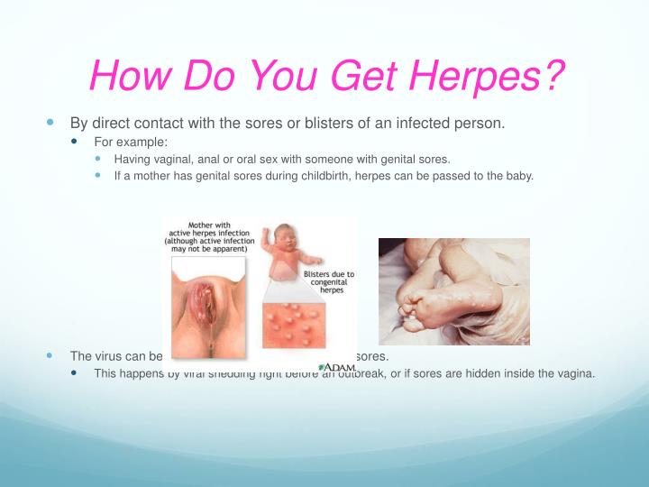 Get genital herpes from oral sex Think, Get genital herpes from oral sex about such