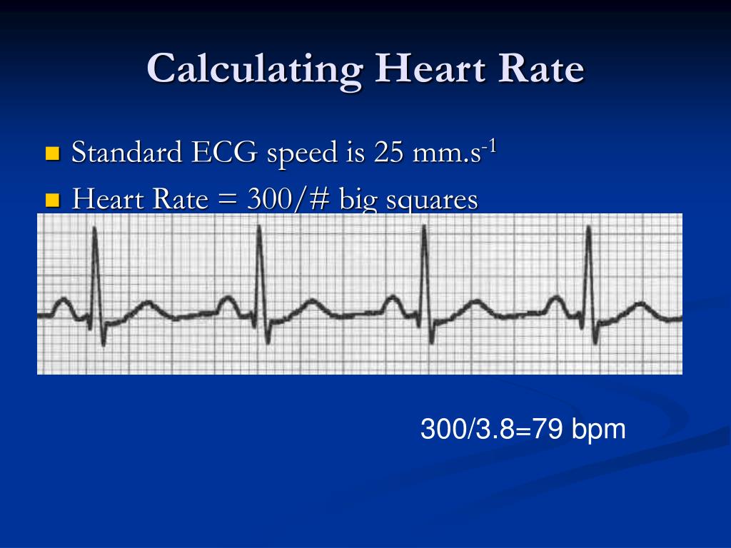 PPT The Basics Of ECG Interpretation PowerPoint Presentation Free PPT The Basics Of ECG Interpretation PowerPoint Presentation Free