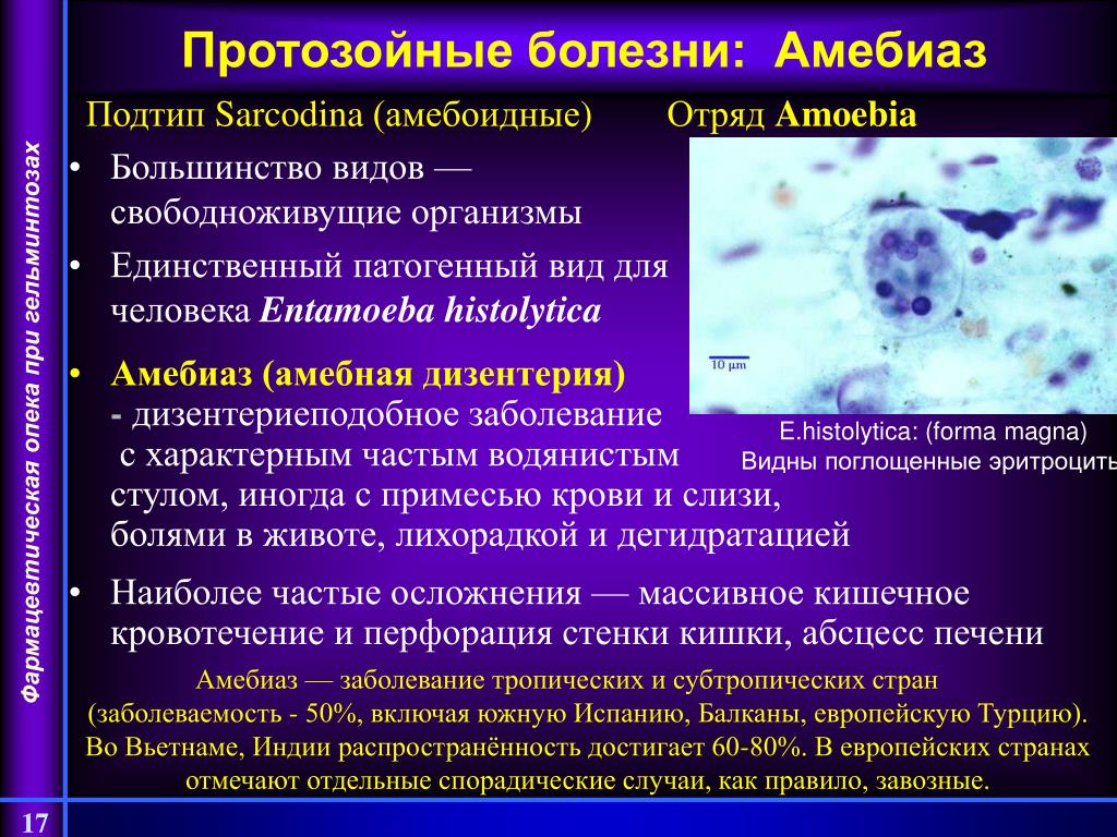 Заболевания вызванные амебами. Протозойные инфекции. Возбудители протозойных инфекций. Профилактика протозойных инфекций.