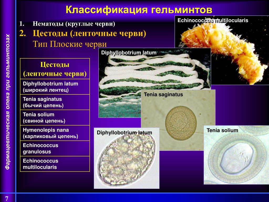 Заболевания вызываемые ленточными червями. Широкий лентец классификация гельминта. Классификация гельминтов ленточных червей. Классификация классификация свиного цепня. Ленточные черви паразиты систематика.