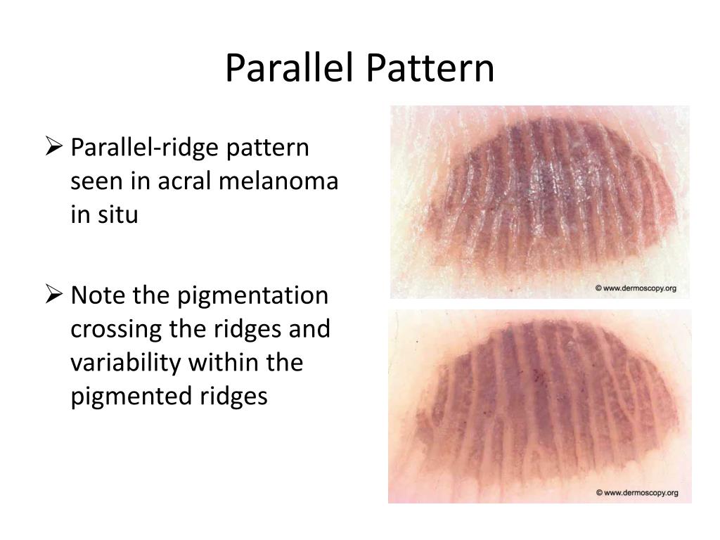 PPT Dermatology GP Education & Networking Event PowerPoint