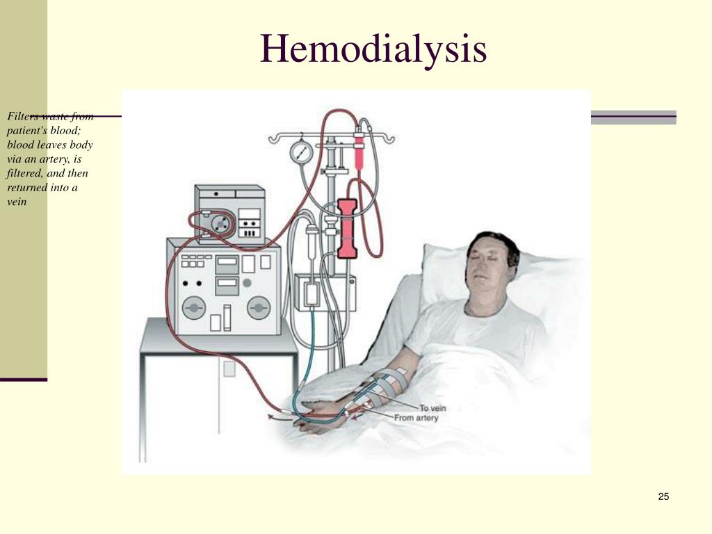 hemodialysis case study presentation