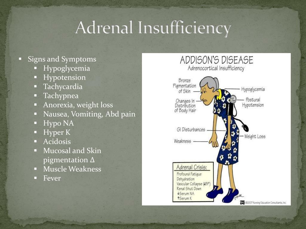 PPT Acute Adrenal Crisis Related To Exogenous Steroid Use And ppt-acute-adrenal-crisis-related-to-exogenous-steroid-use-and