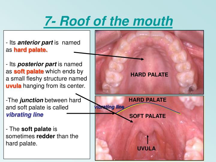 ppt-powerpoint-presentation-id-6172871