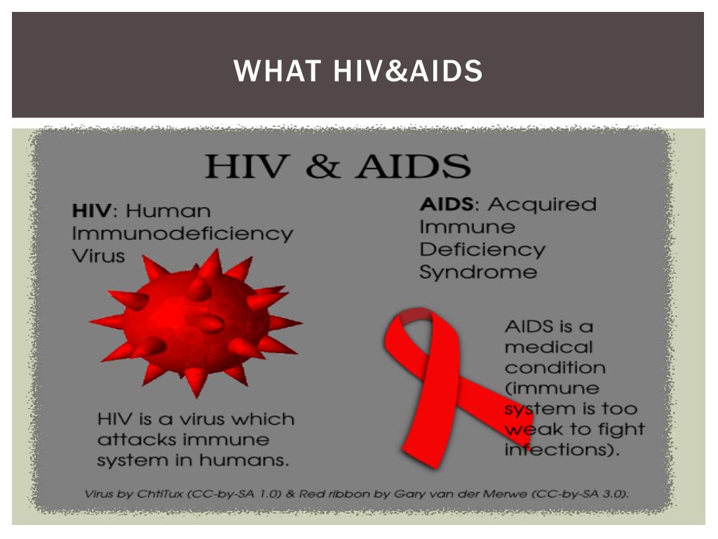 presentation for hiv
