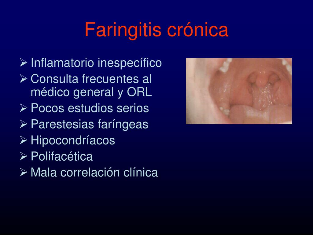 Pathway Faringitis