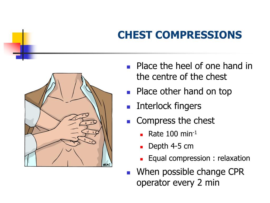 PPT Basic Life Support Cardio Pulmonary Resuscitation PowerPoint