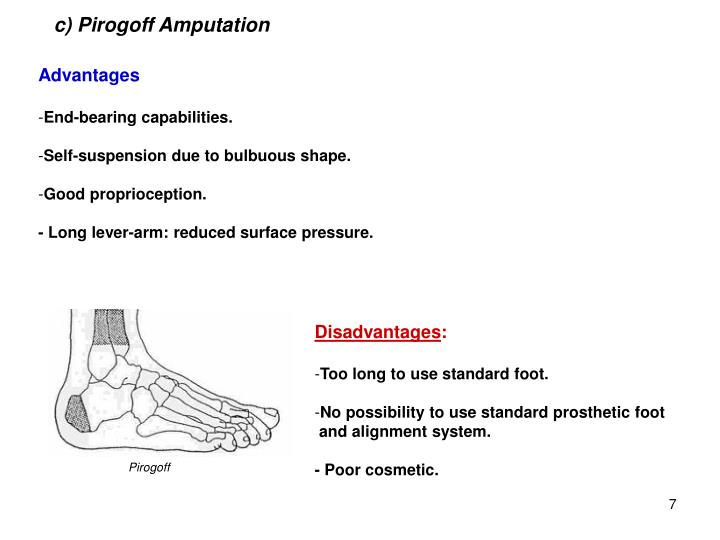 PPT - LOWER LIMB LEVEL AMPUTATION PowerPoint Presentation - ID:6194137