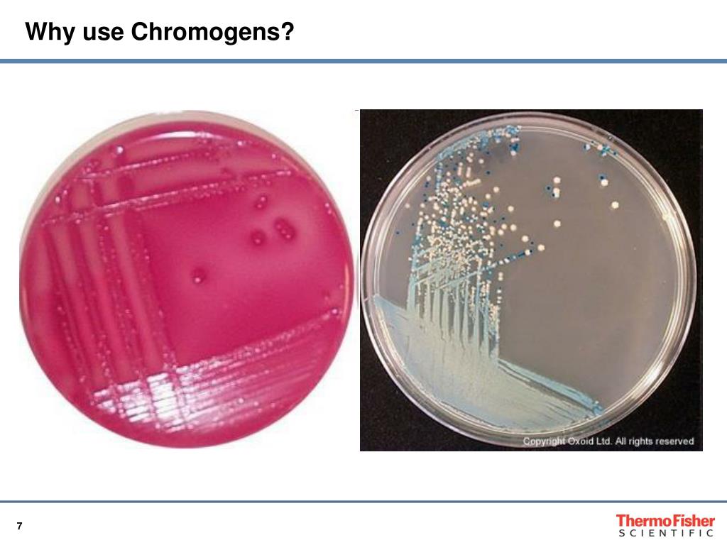 PPT - Advances in culture media design (Chromogen and Inhibigen ...