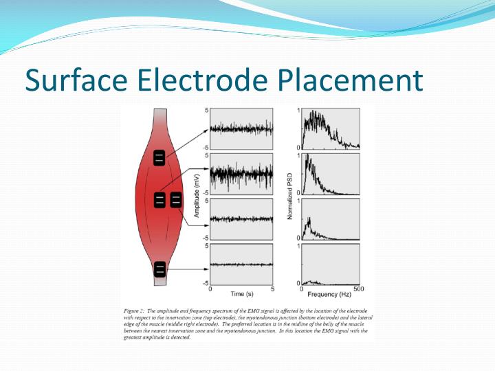 PPT Electromyography ( EMG ) PowerPoint Presentation ID6228413