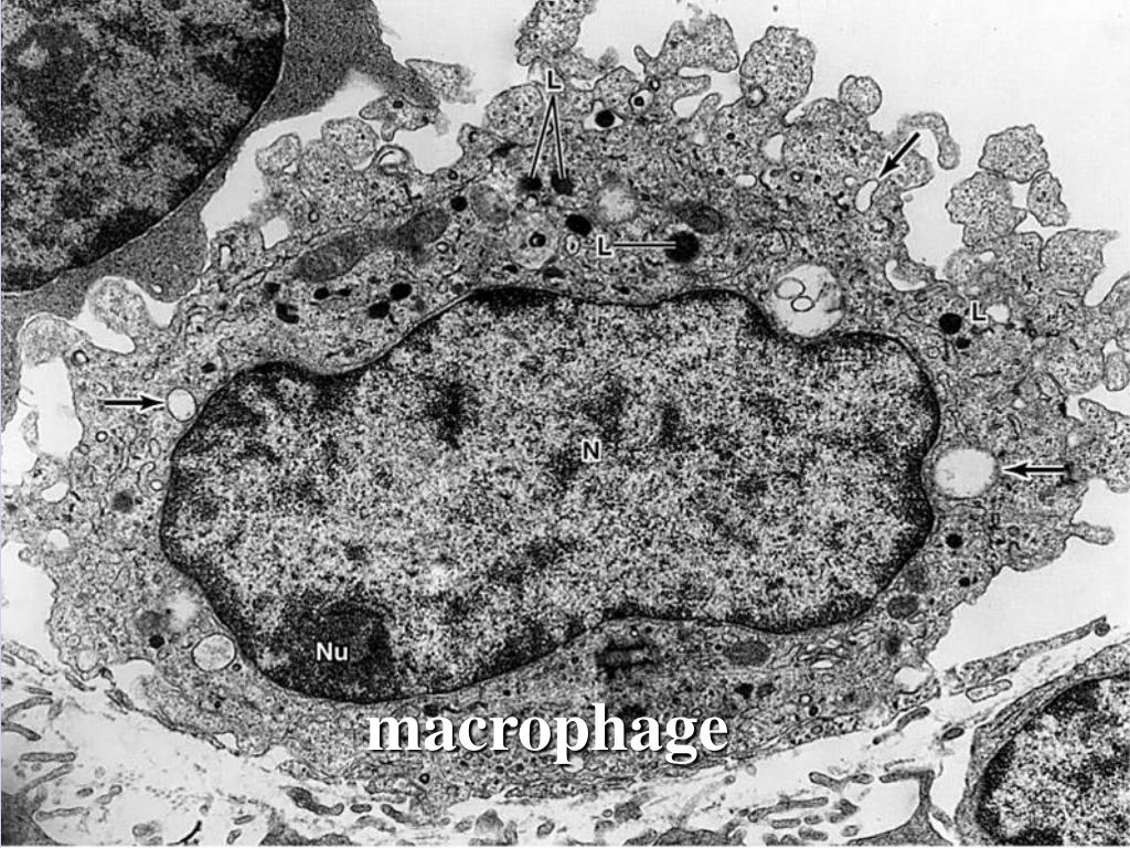 Макрофаги 2 3. Макрофаг гистология Электронограмма. Макрофаг электронная микрофотография. Макрофаг микрофотография гистология. Лизосома электронная микрофотография.