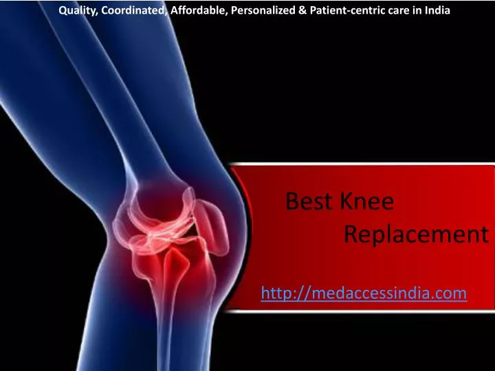 Ppt Best Knee Replacement Powerpoint Presentation Free Download Id 6257380