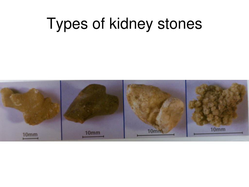 ppt-renal-system-histology-and-models-powerpoint-presentation-free