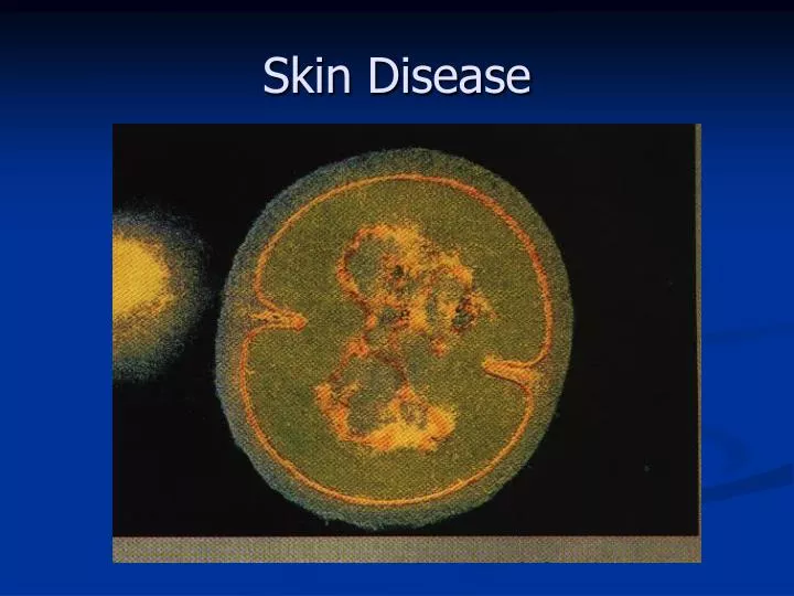 skin disease n.