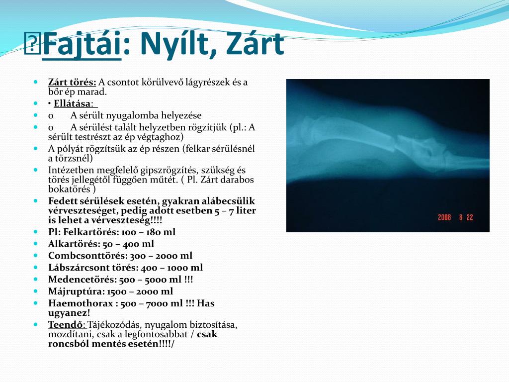 zoovip balzsam onkológiai ízületi fájdalom