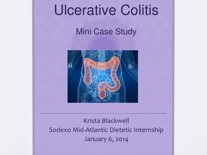 ulcerative colitis mini case study n.