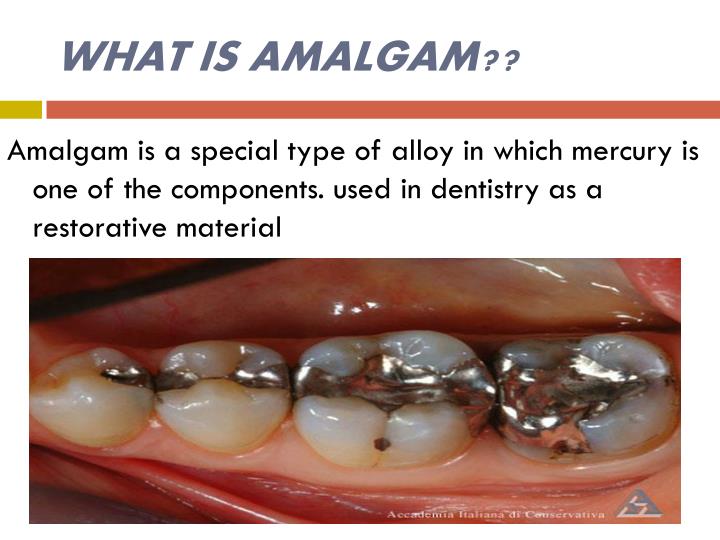 ppt-dental-amalgam-powerpoint-presentation-id-6299866