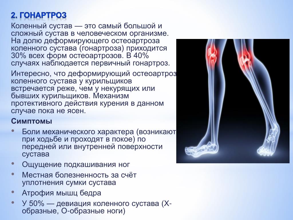Локальный статус нижних конечностей. Мкб 10 деформирующий артроз коленного сустава. Артроз коленного сустава код по мкб 10. Гонартроз коленного сустава код по мкб 10. Деформирующий артроз коленного сустава код по мкб 10 у взрослых.