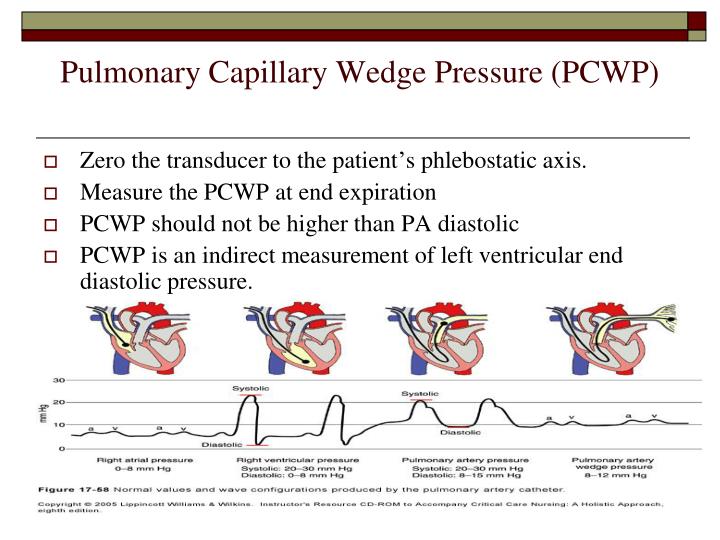 PPT INVASIVE HEMODYNAMIC MONITORING PowerPoint Presentation ID6333249