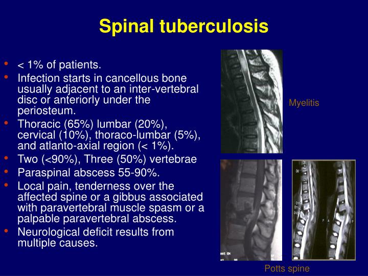 Spinal Cord Tuberculosis