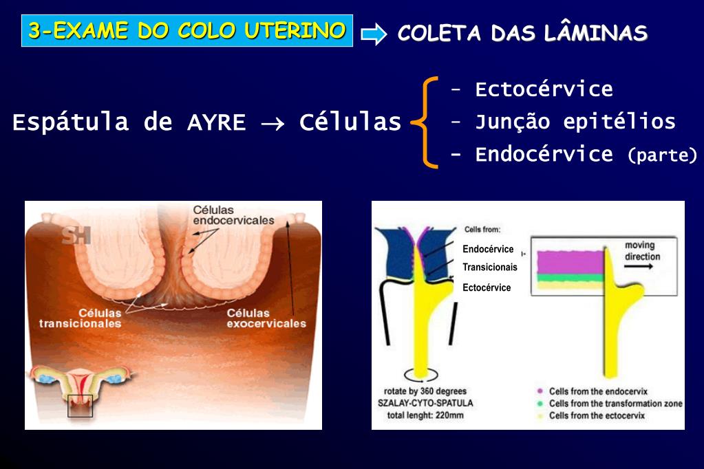 PPT Departamento De Ginecologia E Obstetr cia Unidade I De 
