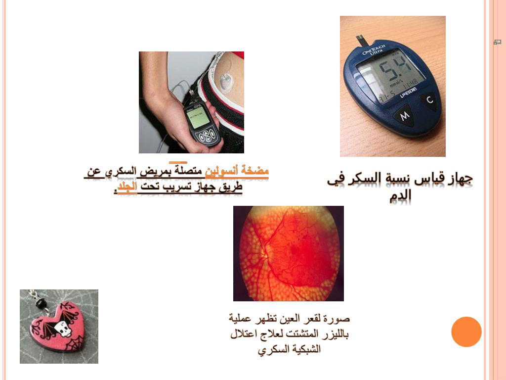PPT السكري PowerPoint Presentation, free download ID6346938