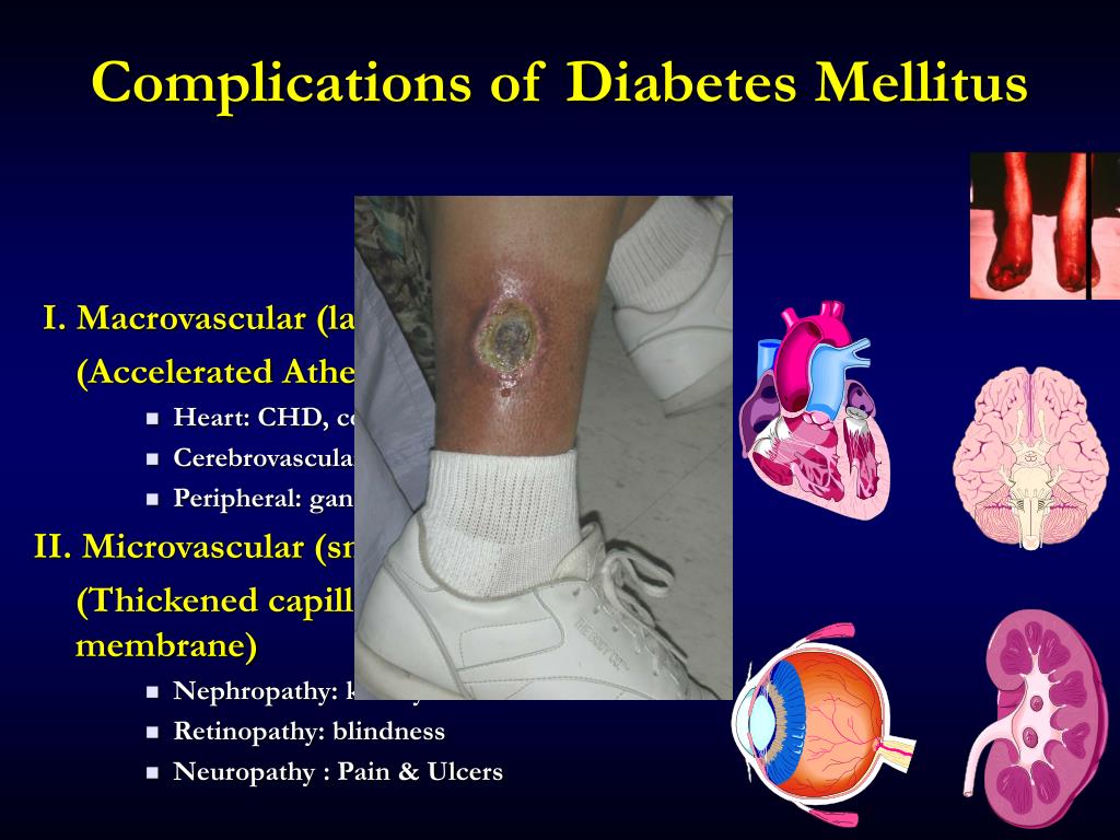 PPT - Diabetes Mellitus for Dentist PowerPoint Presentation, free
