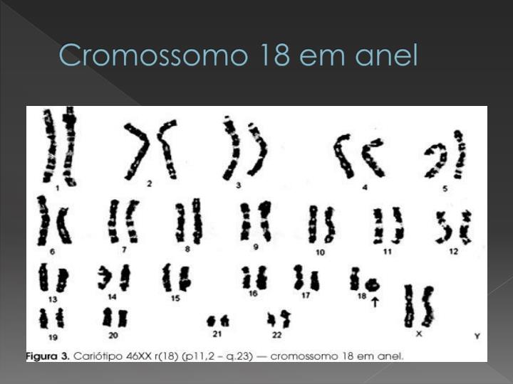 Cromossomo Em Anel