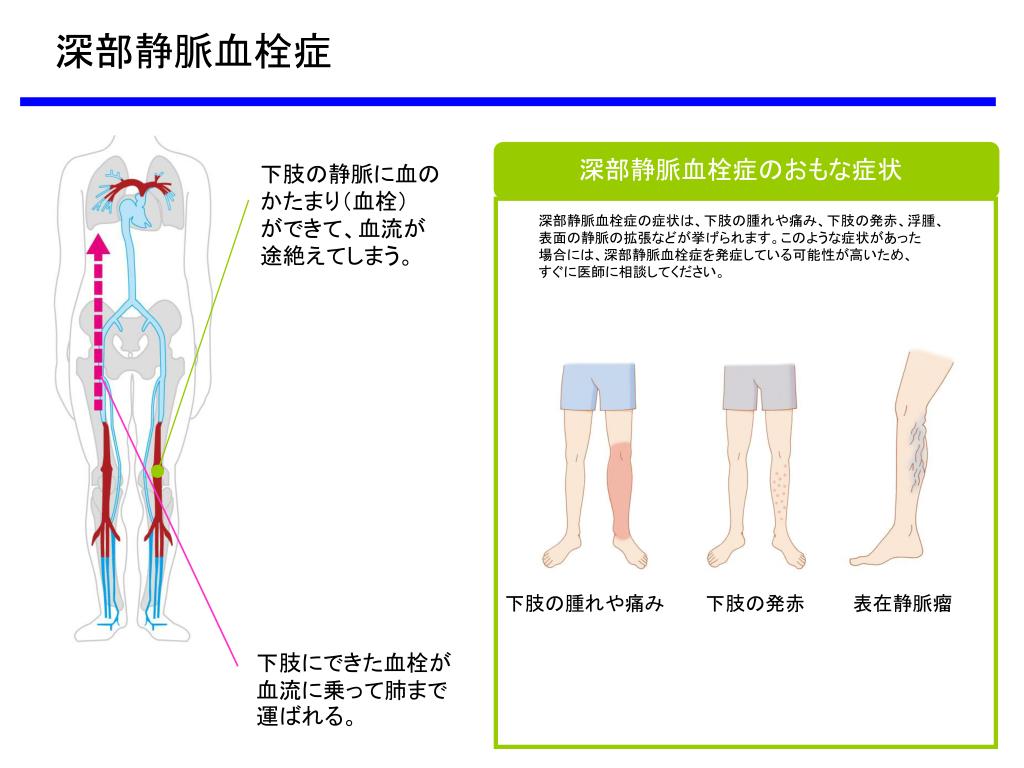 いつ医師に連絡すべきでしょうか?