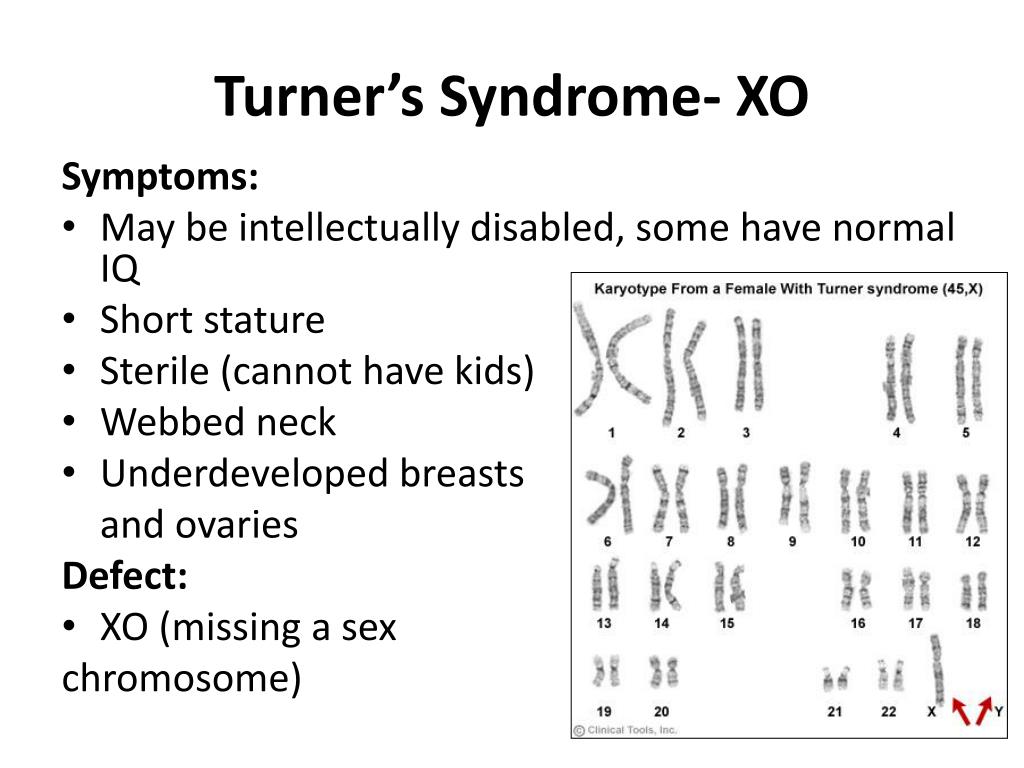 PPT - Karyotype and Chromosomal Mutation Notes PowerPoint Presentation ...