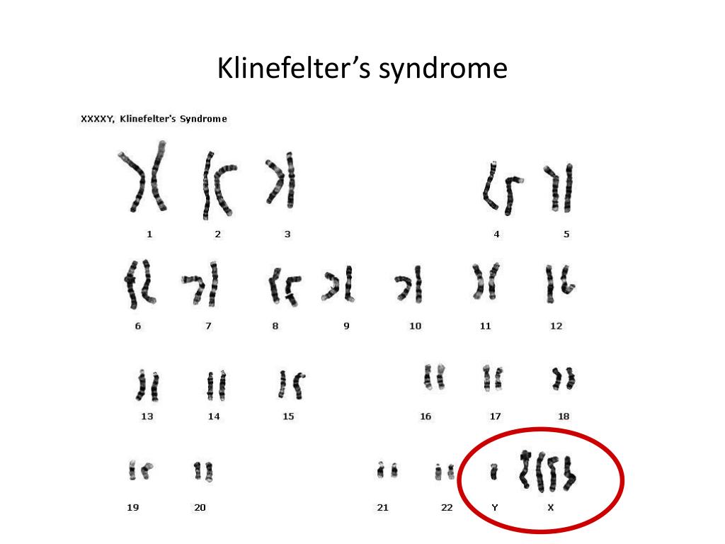 PPT - Chromosomal Abnormalities PowerPoint Presentation, free download ...